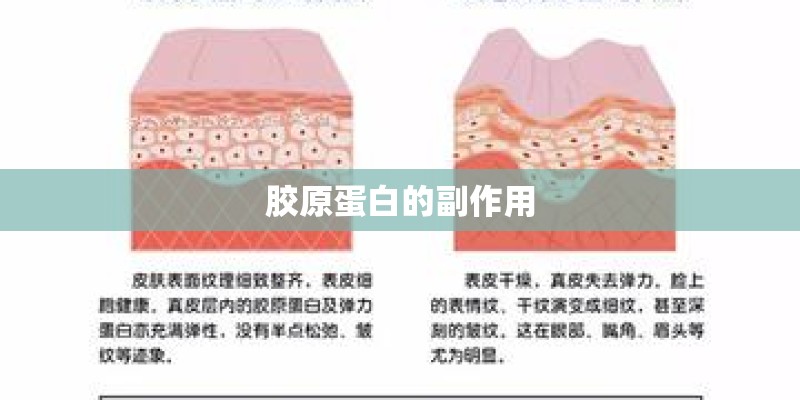 胶原蛋白的副作用
